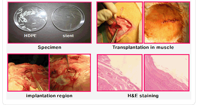 이식시험 - specimen, transplantation, H&E staining
