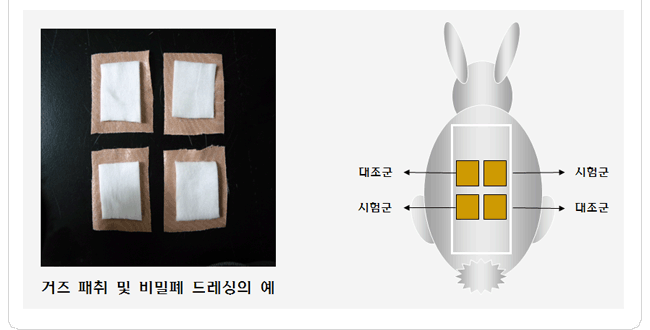 자극성 시험 거즈 패취 및 비밀폐 드레싱 예
